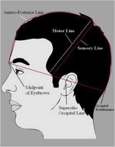best of Neuralgia Facial postherpetic