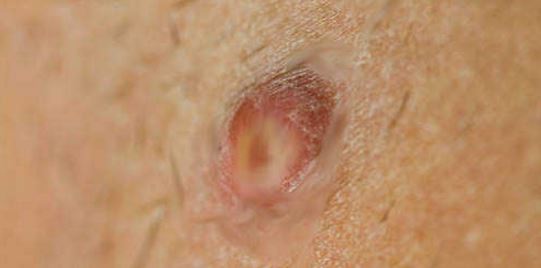 best of And freckles lump anus Small on