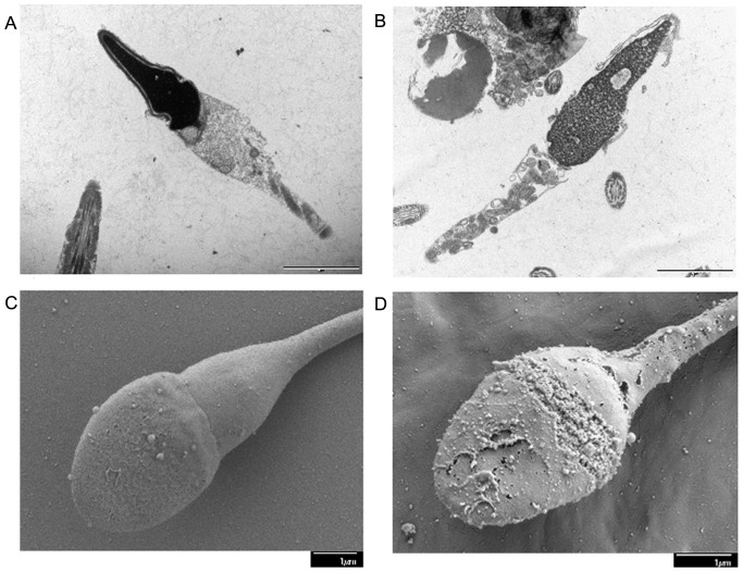 Funnel C. reccomend Micrographs of sperm