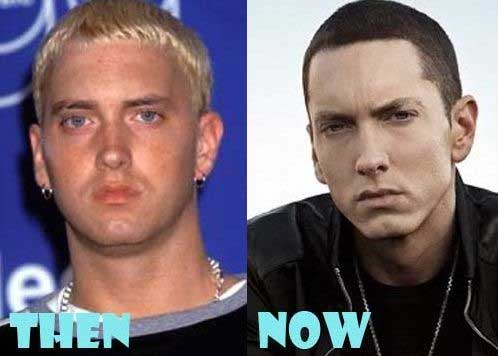 best of Facial surgery Eminem