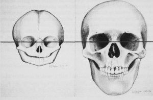 best of Facial growth Cranio