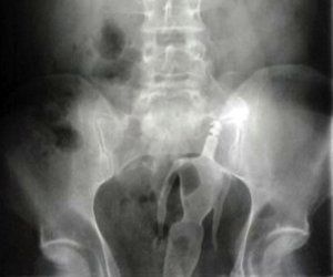 best of X-rays Bizzare anal