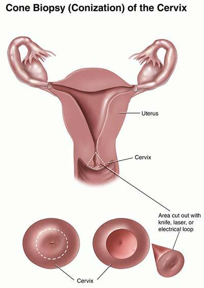 best of After Gynecology sore orgasm cervix