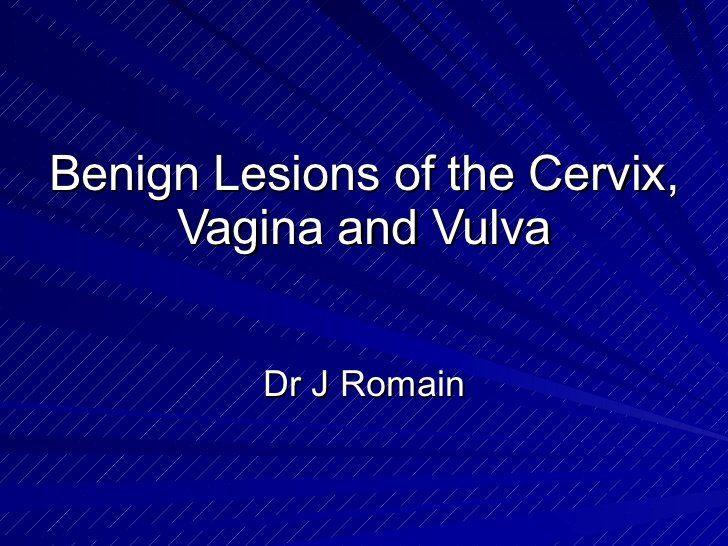best of Of Benign the vagina and diseases vulva