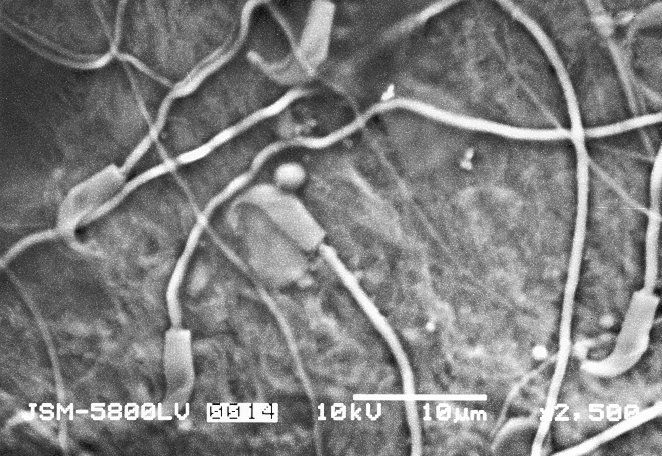 Micrographs of sperm