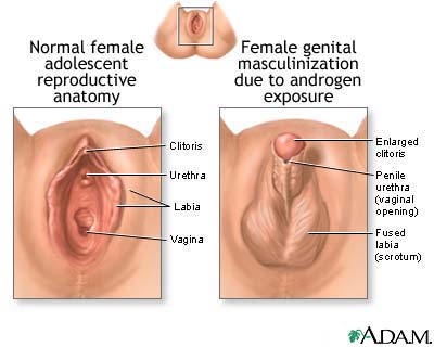 Tabasco reccomend Enlarged clitoris on steroids photos