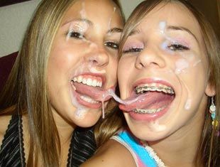 Girls with braces spunk