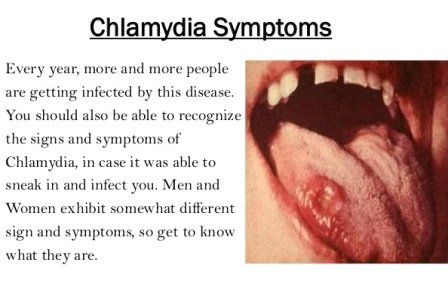 Meatball reccomend Chlamydia in the anus