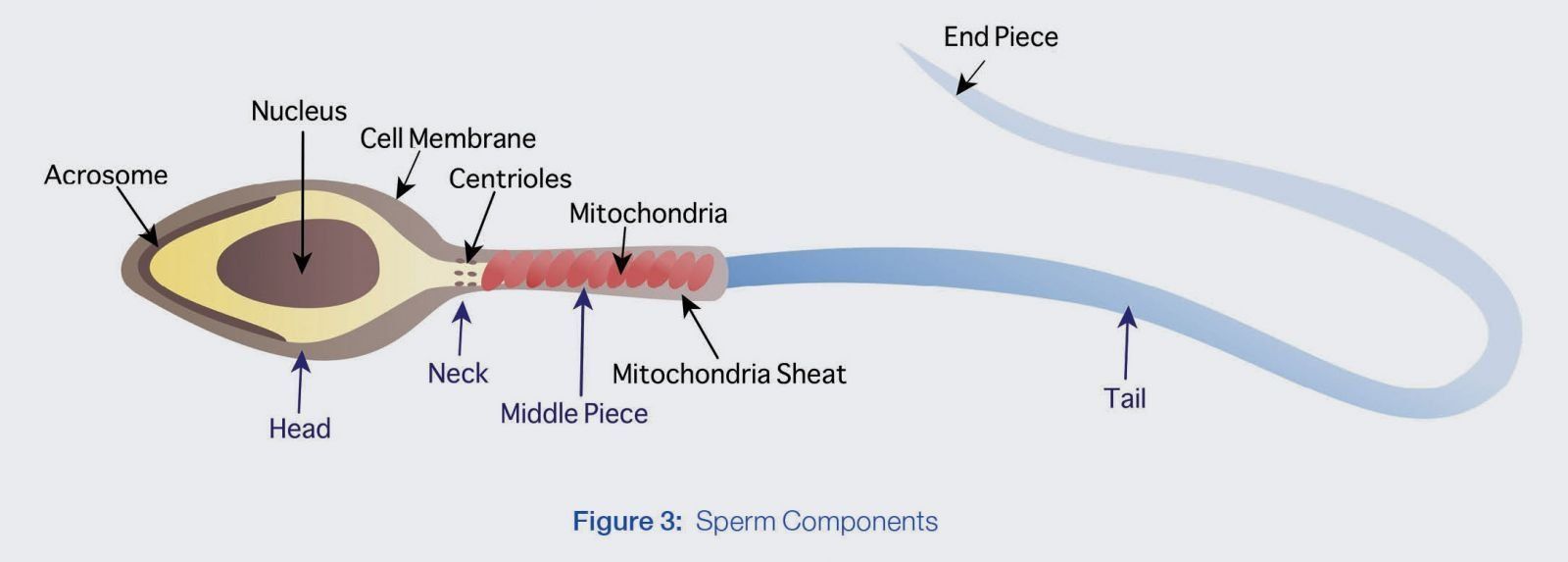 Human sperm tail abnormalities