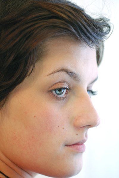 best of Moles on humans Facial