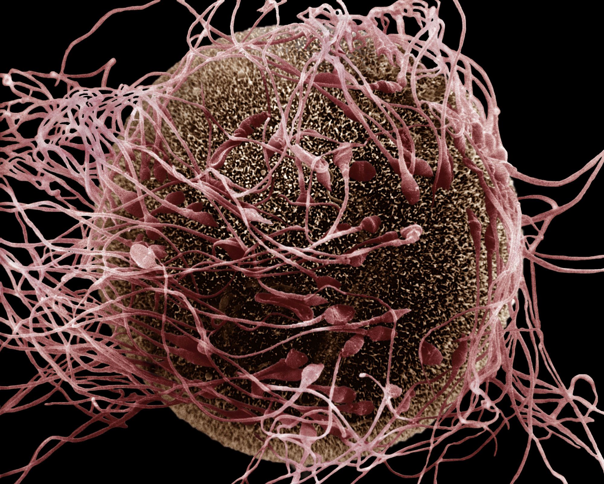 Micrographs of sperm