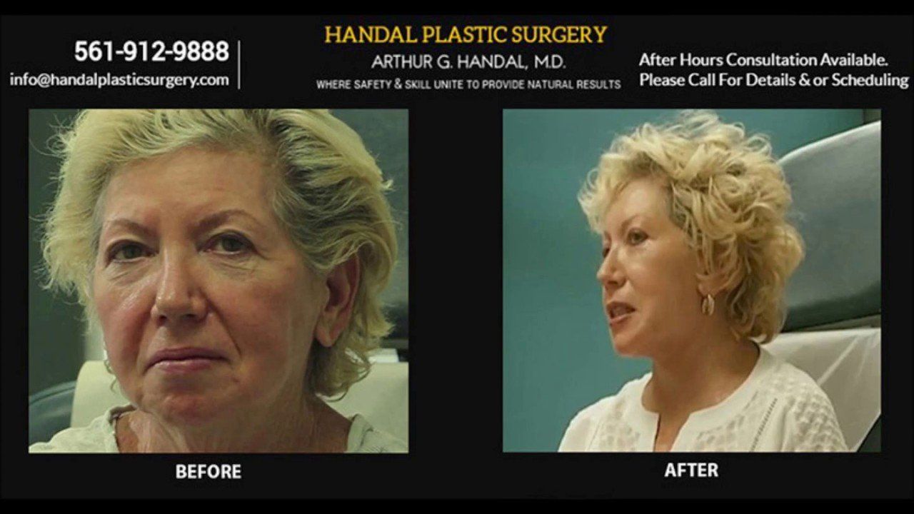 Boca raton facial cosmetic surgery