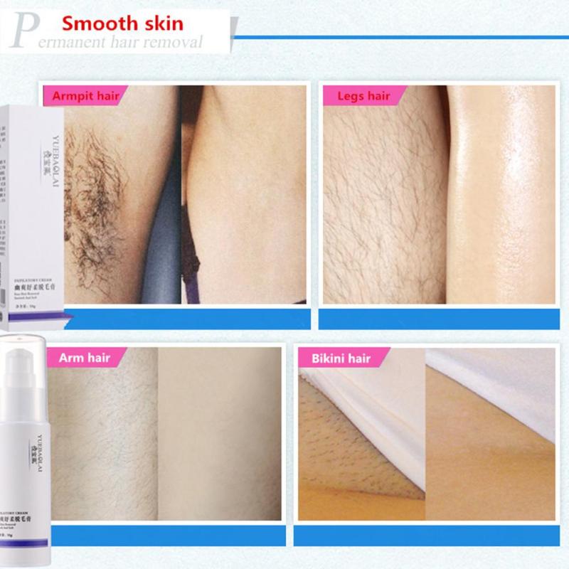 Brown E. reccomend Bikini hair removal creams
