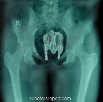 Catnip reccomend Bizzare anal x-rays