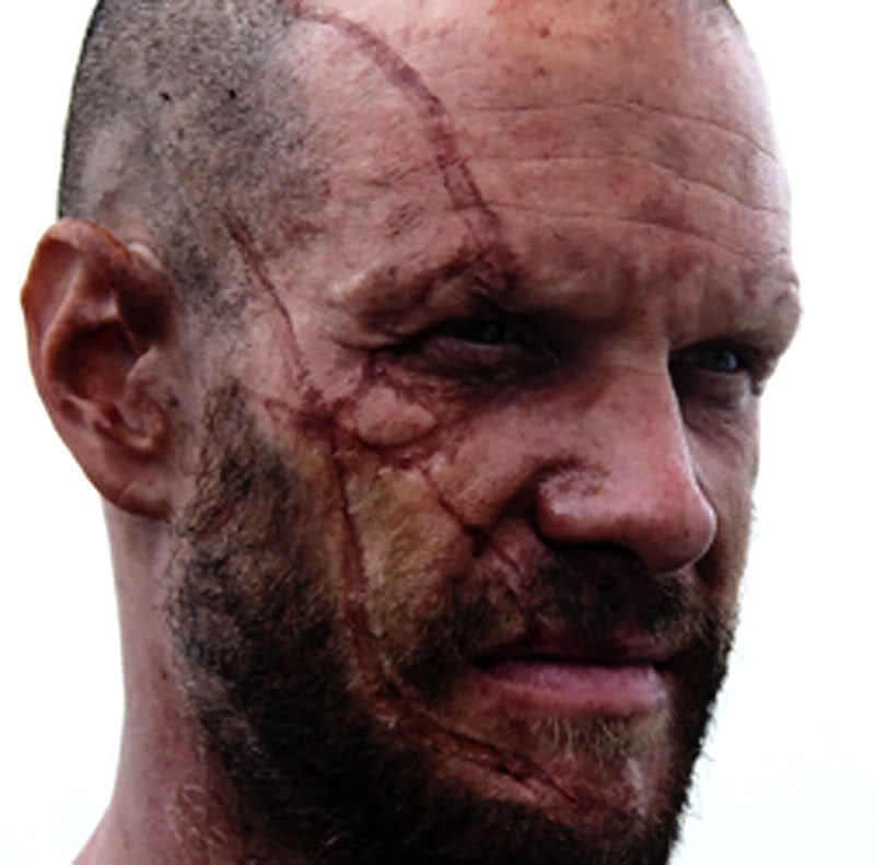 Actor facial scars