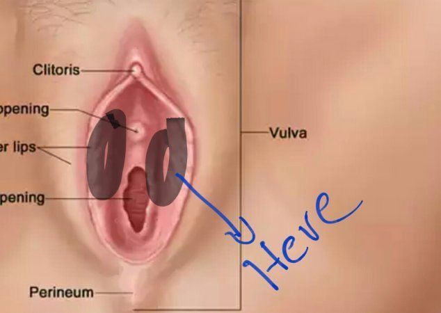 Dove reccomend Clogged glands in your clitoris