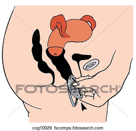Hand vaginal insertions