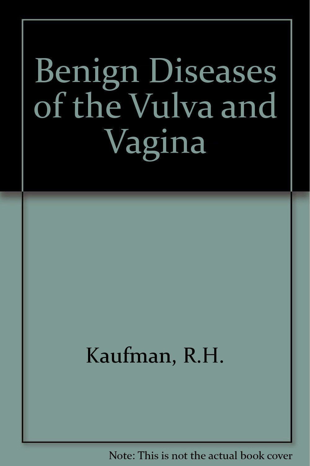 Darth V. reccomend Benign diseases of the vulva and vagina