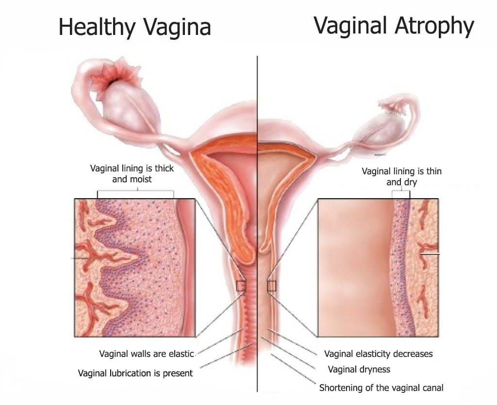 best of Vagina lubrication Dry
