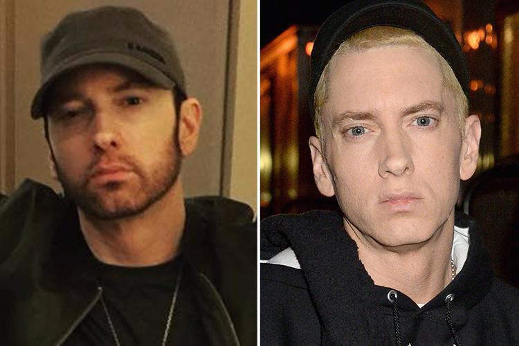 Eminem facial surgery