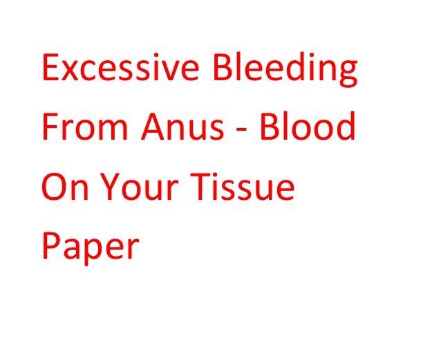 Excess tissue anus