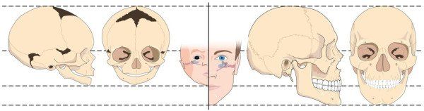 best of Facial growth Cranio