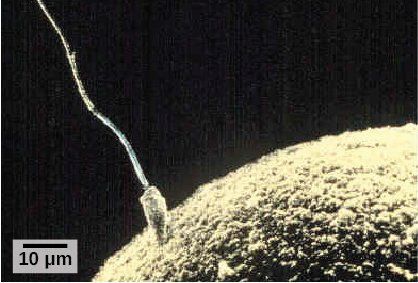 Foul P. reccomend Micrographs of sperm