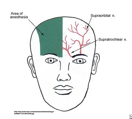 best of Neuralgia Facial postherpetic