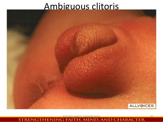 Large engorged clitoris