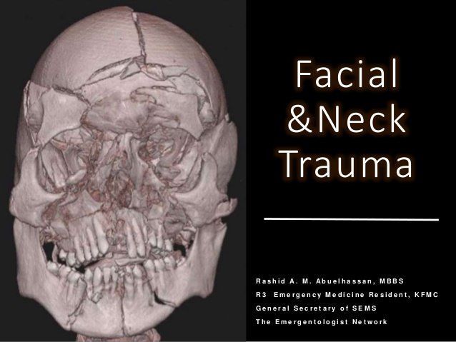 best of Facial Pictures injuries of neck