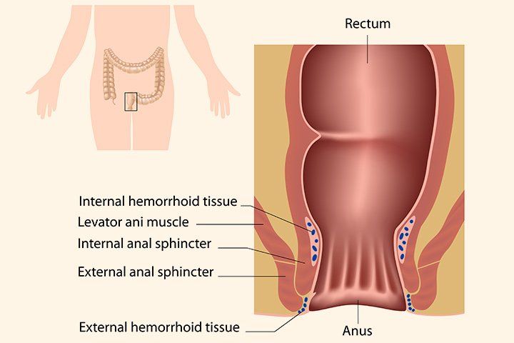 Shrink cyst near anus