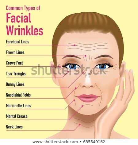 best of Wrinkles Treat facial