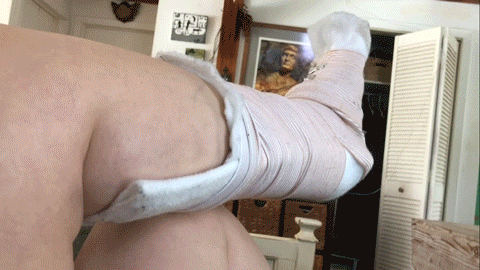 best of Crutches leg cast