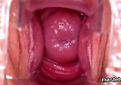 WMD reccomend speculum amateur pussy spreading cervix