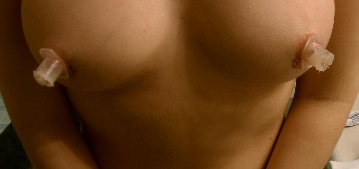 Short-Fuse reccomend flat nipples