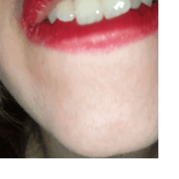 best of Mouth uvula girl epiglttis endoscope