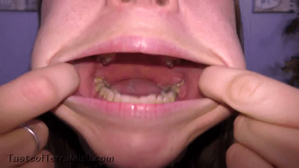 Wasp reccomend want tongue clips4sale